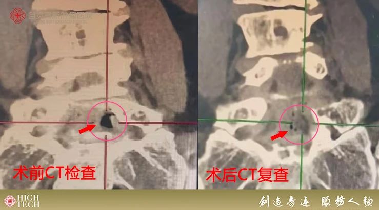 腳痛、坐立不安？這項(xiàng)治療可以助你恢復(fù)活力